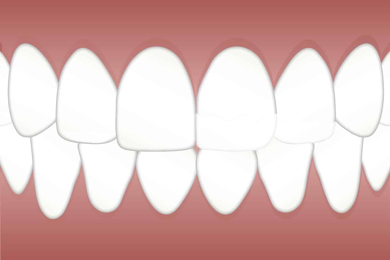3 טיפולים שחובה לעשות אצל רופא שיניים