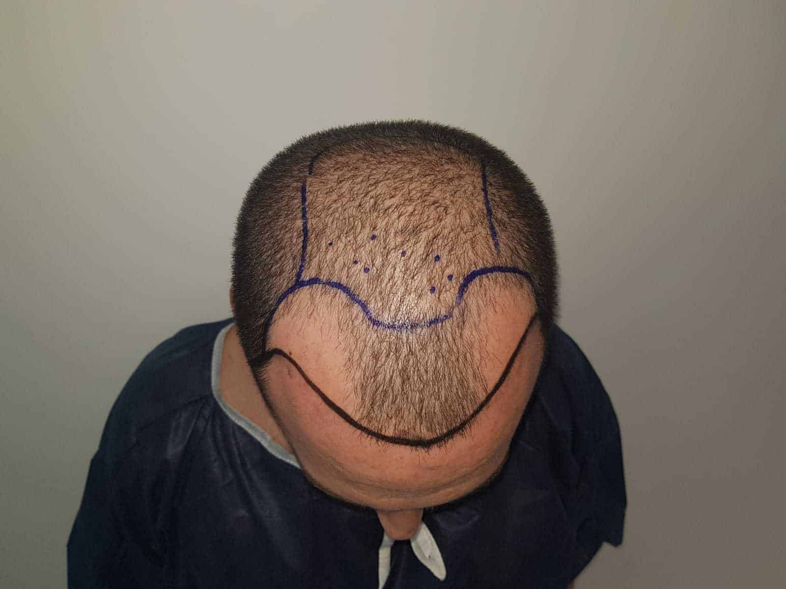 שלב ב׳: אבחון מקצועי